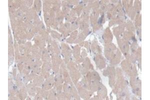 Immunohistochemistry (IHC) image for anti-CD7 (CD7) (AA 23-128) antibody (ABIN7444427)