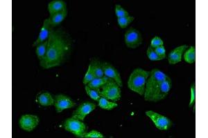 Immunofluorescent analysis of HepG2 cells using ABIN7160861 at dilution of 1:100 and Alexa Fluor 488-congugated AffiniPure Goat Anti-Rabbit IgG(H+L) (SIRT3 Antikörper  (AA 20-130))