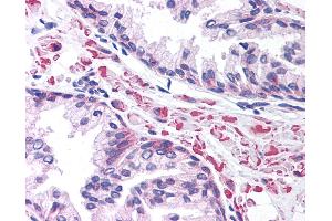 Anti-LEF1 antibody IHC of human prostate. (LEF1 Antikörper  (AA 51-100))