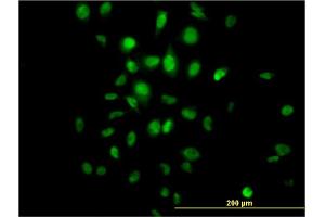 Immunofluorescence of monoclonal antibody to HDAC3 on HeLa cell.