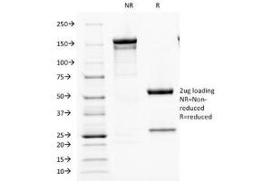 SDS-PAGE Analysis of Purified, BSA-Free Parathyroid Hormone Antibody (clone PTH/1173). (PTH Antikörper  (AA 32-115))