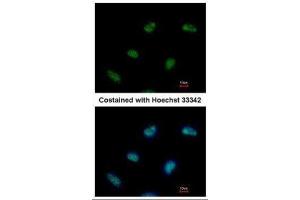 ICC/IF Image Immunofluorescence analysis of paraformaldehyde-fixed HeLa, using Rad9, antibody at 1:500 dilution. (RAD9A Antikörper  (Center))