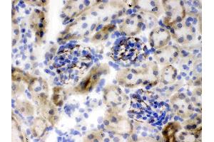 Immunohistochemistry (IHC) image for anti-Nestin (NES) (AA 252-290), (N-Term) antibody (ABIN3044529)