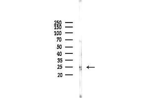 Western blot analysis of lysates from HUVEC cells(starvation 24h treatment), using Cathepsin D Antibody at 1/1000 dilution.