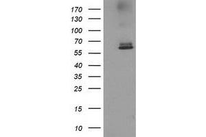 HEK293T cells were transfected with the pCMV6-ENTRY control (Left lane) or pCMV6-ENTRY ACOT12 (Right lane) cDNA for 48 hrs and lysed. (ACOT12 Antikörper)