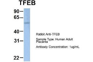 Western Blotting (WB) image for anti-Transcription Factor EB (TFEB) (Middle Region) antibody (ABIN2787554)