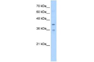 TMEM104 antibody used at 5 ug/ml to detect target protein. (TMEM104 Antikörper  (Middle Region))