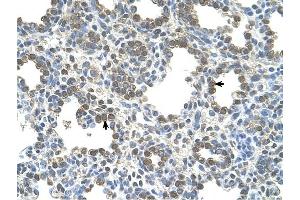 SLC26A5 antibody was used for immunohistochemistry at a concentration of 4-8 ug/ml to stain Alveolar cells (arrows) in Human Lung.