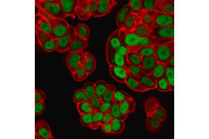 Immunofluorescence Analysis of PFA-fixed MCF-7 cells labeled withFOXA1 Monoclonal Antibody (FOXA1/1518)followed by goat anti- mouse IgG-CF488. (FOXA1 Antikörper  (AA 372-472))