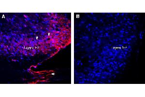 Expression of VGLUT1 in rat spinal cord.