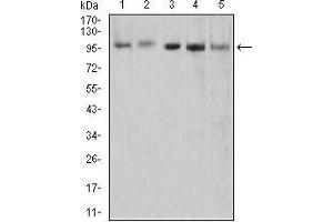 Western blot analysis using XRN2 mouse mAb against HEK293 (1), NTERA-2 (2), LNcap (3), HepG2 (4), and PC-3 (5) cell lysate. (XRN2 Antikörper  (AA 398-547))