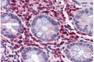 Human Colon (formalin-fixed, paraffin-embedded) stained with TRIM21 antibody ABIN337310 at 5 ug/ml followed by biotinylated anti-goat IgG secondary antibody ABIN481715, alkaline phosphatase-streptavidin and chromogen. (TRIM21 Antikörper  (AA 386-398))
