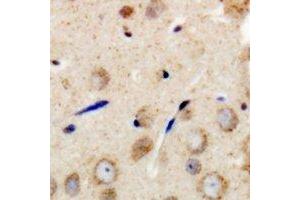 Immunohistochemical analysis of GAB1 staining in human brain formalin fixed paraffin embedded tissue section. (GAB1 Antikörper  (C-Term))