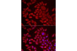 Immunofluorescence analysis of HeLa cells using  antibody (ABIN6129825, ABIN6136640, ABIN6136641 and ABIN6222174). (AGPAT2 Antikörper  (AA 199-278))