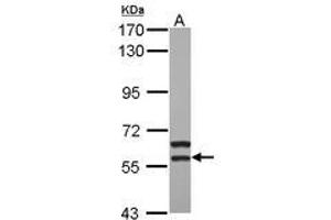 Image no. 1 for anti-Megakaryocyte-Associated tyrosine Kinase (MATK) (AA 250-464) antibody (ABIN1499325) (MATK Antikörper  (AA 250-464))