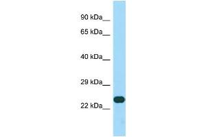 Host: Rabbit Target Name: CCDC59 Sample Type: HepG2 Whole Cell lysates Antibody Dilution: 1.