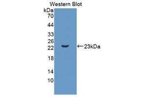Western blot analysis of recombinant Mouse IL11. (IL-11 Antikörper  (AA 25-199))