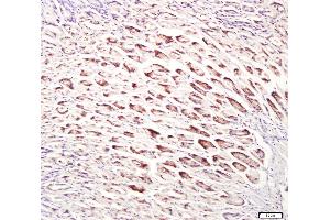 Paraformaldehyde-fixed, paraffin embedded mouse stomach, Antigen retrieval by boiling in sodium citrate buffer (pH6. (UNC5B Antikörper  (AA 188-260))