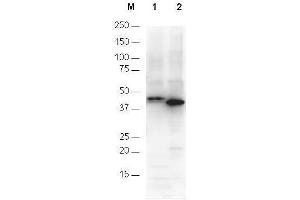 Anti-6X His epitope tag polyclonal antibody detects His-tagged recombinant proteins by western blot. (His Tag Antikörper)