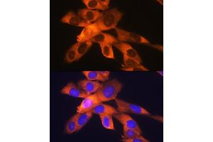 Immunofluorescence analysis of NIH-3T3 cells using RPS19 Rabbit mAb (ABIN1681275, ABIN3017969, ABIN3017970 and ABIN7101552) at dilution of 1:100 (40x lens). (RPS19 Antikörper)