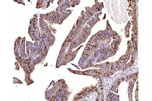IHC analysis of Geminin/GMNN using anti-Geminin/GMNN antibody (ABIN7600598). (Geminin Antikörper  (AA 21-196))