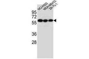CHRNA10 Antibody (Center) western blot analysis in NCI-H292,MDA-MB453,ZR-75-1 cell line lysates (35µg/lane). (CHRNA10 Antikörper  (Middle Region))