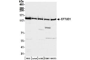 Western Blotting (WB) image for anti-Elongation Factor Tu GTP Binding Domain Containing 1 (EFTUD1) (AA 700-750) antibody (ABIN7452817)