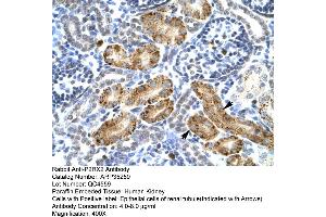 Immunohistochemistry (IHC) image for anti-Purinergic Receptor P2X, Ligand Gated Ion Channel 2 (P2RX2) (Middle Region) antibody (ABIN2776215)