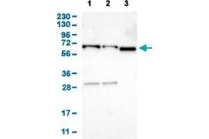 Western Blot analysis of (1) human cell line RT-4 (2) human cell line U-251MG sp, and (3) human plasma (IgG/HSA depleted). (EIF2AK1 Antikörper  (AA 34-180))