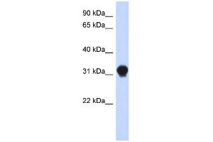 WB Suggested Anti-DNALI1 Antibody Titration: 0. (DNALI1 Antikörper  (N-Term))
