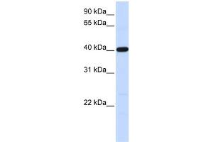 WB Suggested Anti-TMOD3 Antibody Titration: 0. (TMOD3 Antikörper  (N-Term))