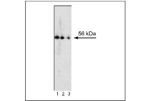 Western blot analysis of RORgammat expression by mouse thymocytes.