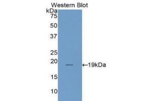 Western blot analysis of the recombinant protein. (IL1RN Antikörper  (AA 26-177))