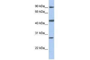 CENPI antibody used at 1 ug/ml to detect target protein. (CENPI Antikörper  (N-Term))