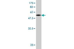 Western Blot detection against Immunogen (55. (Connexin 31 Antikörper  (AA 1-270))