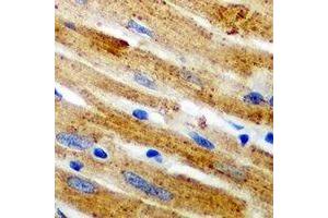 Immunohistochemical analysis of Calpain 1 staining in mouse heart formalin fixed paraffin embedded tissue section. (CAPN1 Antikörper)