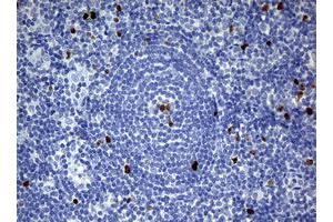 Image no. 7 for anti-Antigen Identified By Monoclonal Antibody Ki-67 (MKI67) (AA 1160-1493) antibody (ABIN1490857) (Ki-67 Antikörper  (AA 1160-1493))