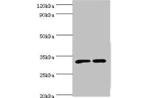 Western blot All lanes: SLC25A15 antibody at 6 μg/mL Lane 1: Mouse liver tissue Lane 2: Mouse stomach tissue Secondary Goat polyclonal to rabbit IgG at 1/10000 dilution Predicted band size: 33 kDa Observed band size: 33 kDa (SLC25A15 Antikörper  (AA 1-301))