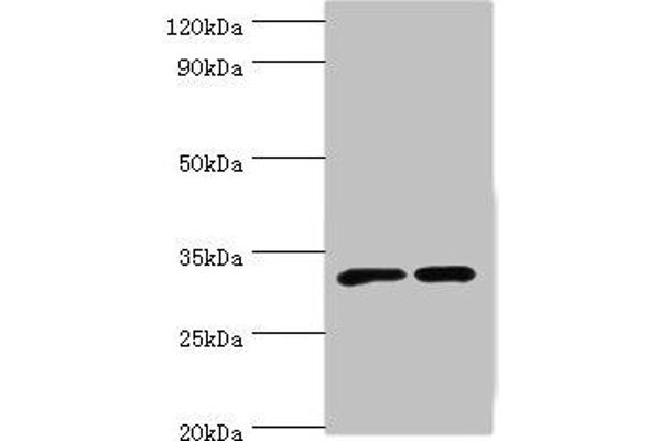 SLC25A15 Antikörper  (AA 1-301)