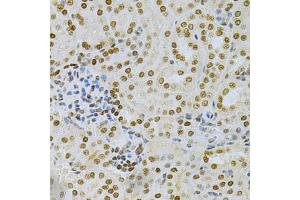 Immunohistochemistry of paraffin-embedded mouse kidney using DKC1 Antibody (ABIN5970956) at dilution of 1/200 (40x lens). (DKC1 Antikörper)