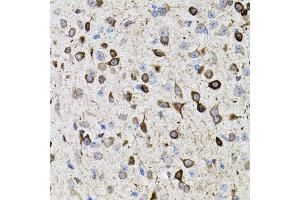 Immunohistochemistry of paraffin-embedded mouse brain using MMP9 antibody (ABIN7268426) at dilution of 1:100 (40x lens).