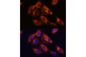 Immunofluorescence analysis of C6 cells using R antibody (ABIN7269856) at dilution of 1:100. (RAPH1 Antikörper  (AA 1-240))