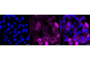 Immunocytochemical staining of HT- cells with PICALM antibody (ABIN7799793), 1:1,000). (Rekombinanter PICALM Antikörper)