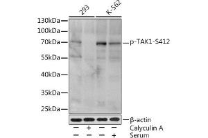 Western blot analysis of extracts of various cell lines, using Phospho-T-S412 Rabbit pAb (ABIN3019511, ABIN3019512, ABIN3019513 and ABIN6225441) at 1:1000 dilution. (MAP3K7 Antikörper  (pSer412))