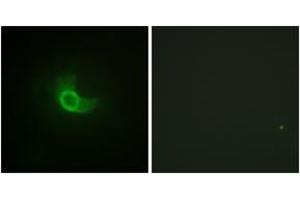 Immunofluorescence analysis of NIH-3T3 cells, using CD130/gp130 (Ab-782) Antibody. (CD130/gp130 Antikörper  (AA 748-797))