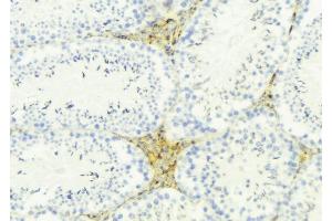 ABIN6274858 at 1/100 staining Mouse testis tissue by IHC-P.