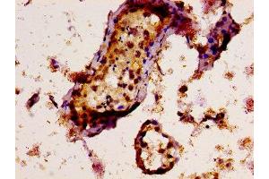 Immunohistochemistry (IHC) image for anti-TAF15 RNA Polymerase II, TATA Box Binding Protein (TBP)-Associated Factor, 68kDa (TAF15) (AA 93-206) antibody (ABIN7171577)