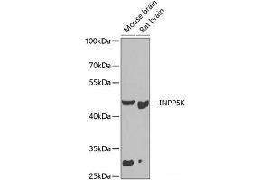 Western blot analysis of extracts of various cell lines using INPP5K Polyclonal Antibody at dilution of 1:1000.