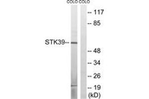Western blot analysis of extracts from COLO cells, using STK39 (Ab-311) Antibody. (STK39 Antikörper  (AA 277-326))