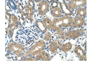 ADH4 antibody was used for immunohistochemistry at a concentration of 4-8 ug/ml to stain Epithelial cells of renal tubule (arrows) in Human Kidney. (ADH4 Antikörper)